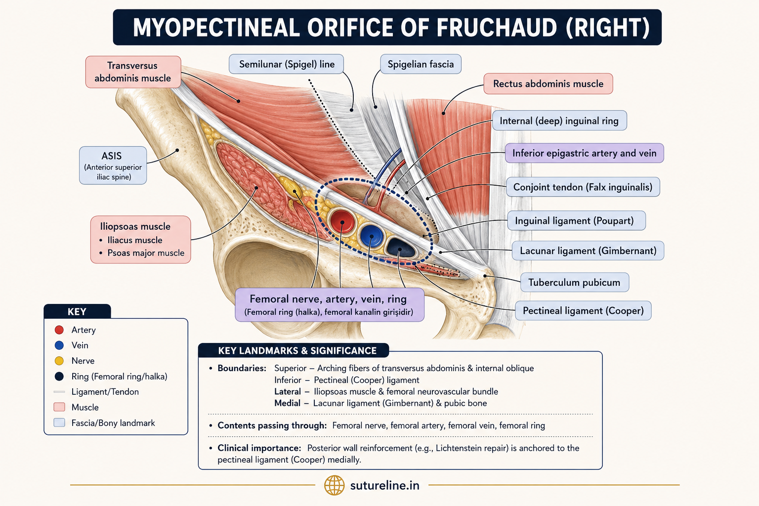 Myopectineal orifice of Fruchaud